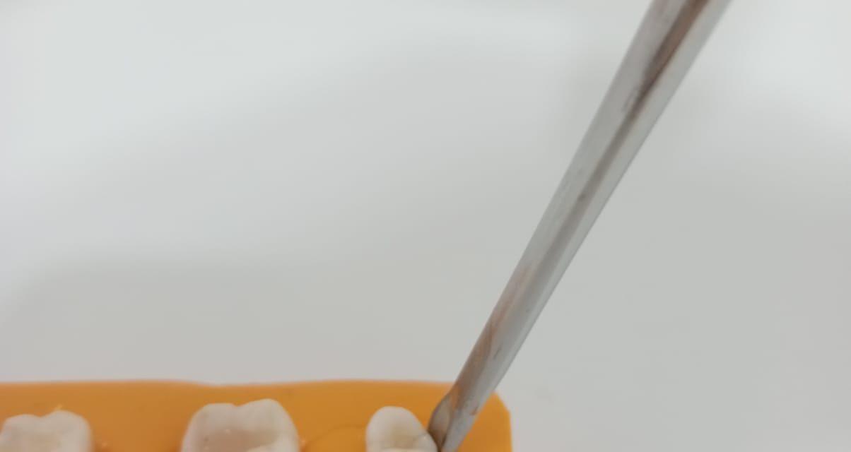 Innovación odontológica: Elevador dental para extracciones más seguras