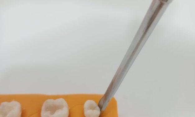 Innovación odontológica: Elevador dental para extracciones más seguras